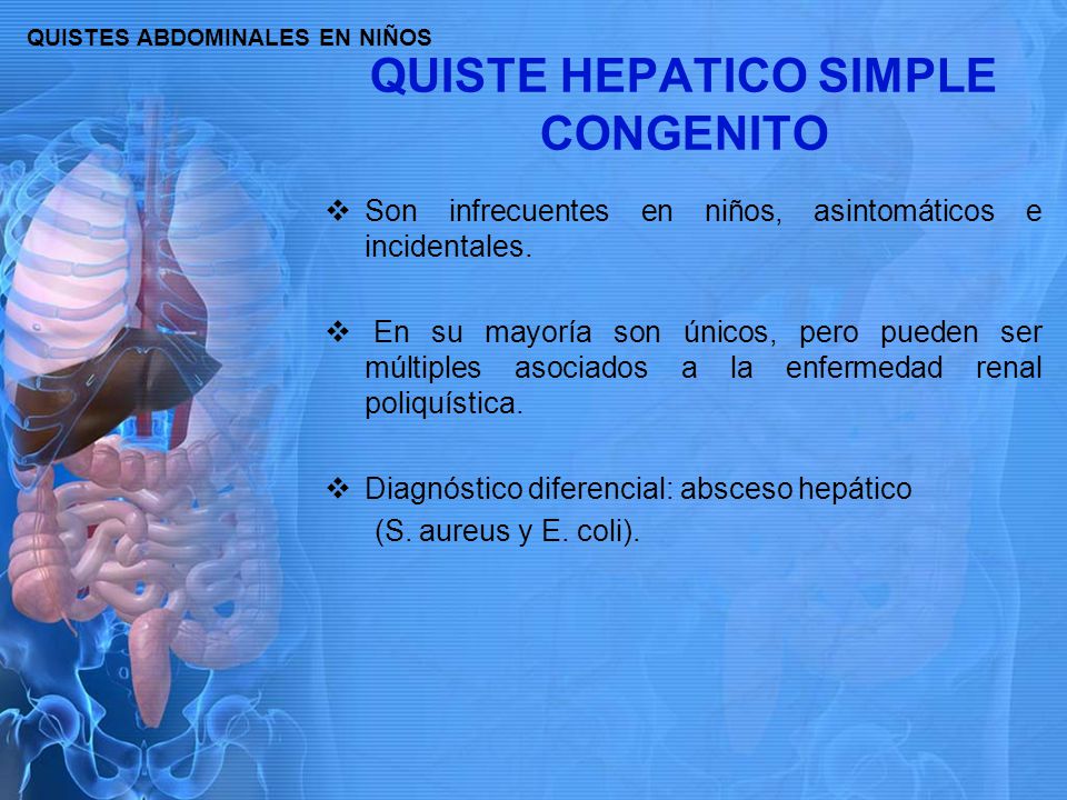 Sintomas quiste hepatico